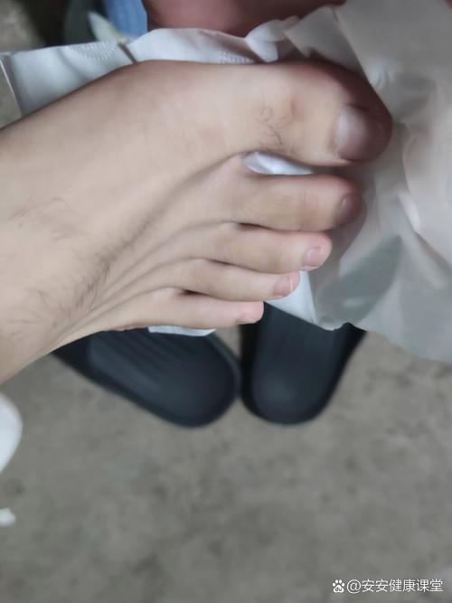刺穿靴子脚心,穿靴子脚疼怎么弄