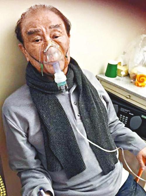 谷歌女高管肺癌去世的简单介绍